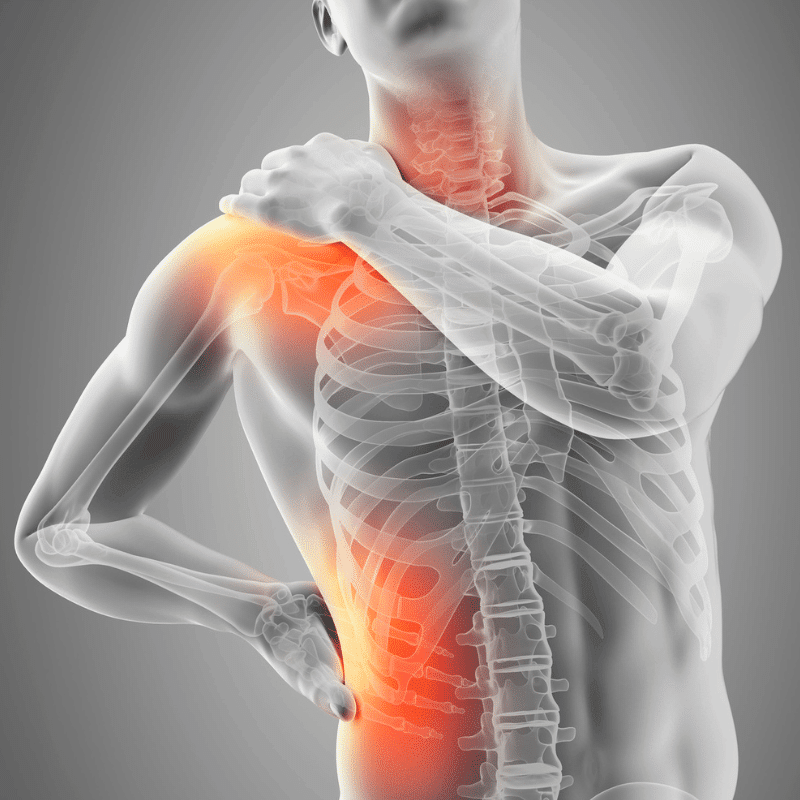Rentgenový snímek lidské kostry se zvýrazněnými body bolesti v krční páteři, ramenou a zádech v červených a oranžových tónech, znázorňující oblast chronické nebo akutní bolesti.