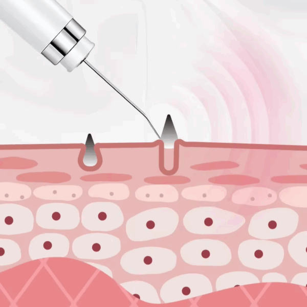 Mikroinjektor aplikující látku do vrstvy buněk, znázorňující proces mikroinjekce v biologickém výzkumu nebo lékařské léčbě.
